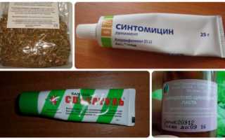 Мази от мозолей — список эффективных препаратов для обработки и заживления мозолей