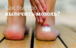 Мозоль